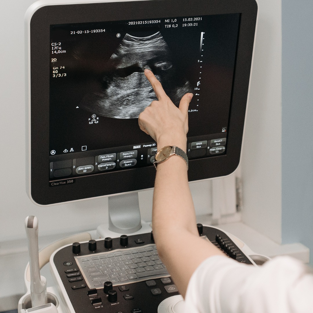 Ultrasound